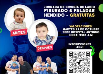 En Casanare, continúan las jornadas de cirugía de labio leporino y paladar hendido