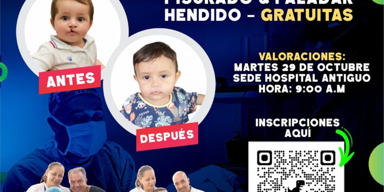En Casanare, continúan las jornadas de cirugía de labio leporino y paladar hendido