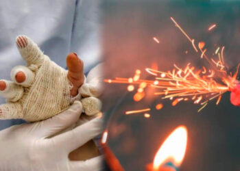 Colombia alcanza las 546 personas quemadas con pólvora