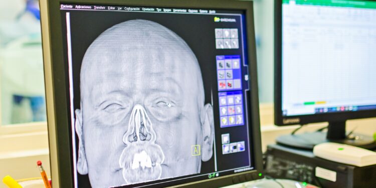 Hospital Regional de la Orinoquía inicia piloto para reactivar servicio de Tomografías