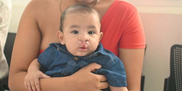 Éxito rotundo en la III Jornada de Cirugías para pacientes con labio fisurado y paladar hendido