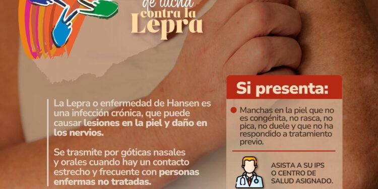 Lepra: en Casanare la detección temprana salva vidas y el estigma debe terminar